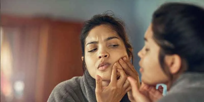 Common Winter Skin Problems & How to Fix Them Nikhil Sharma HairDressing